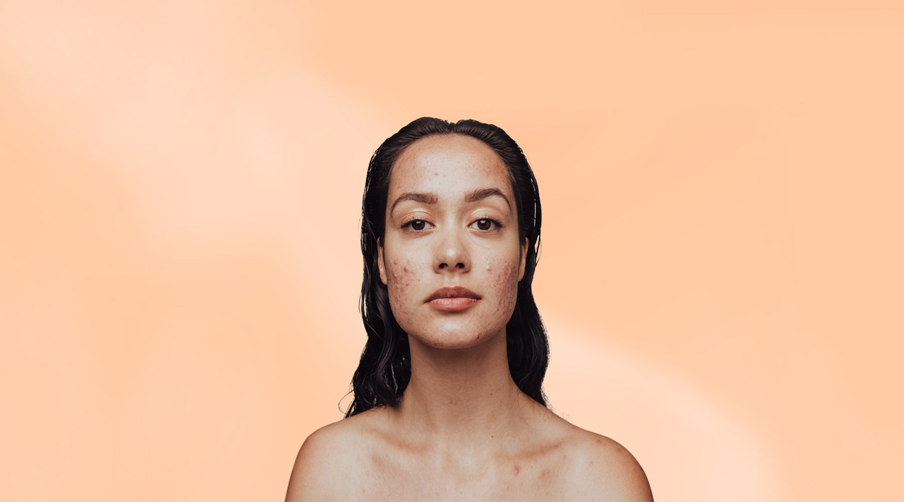 How To Create The Best Skin Care Routine For Acne-Prone Skin