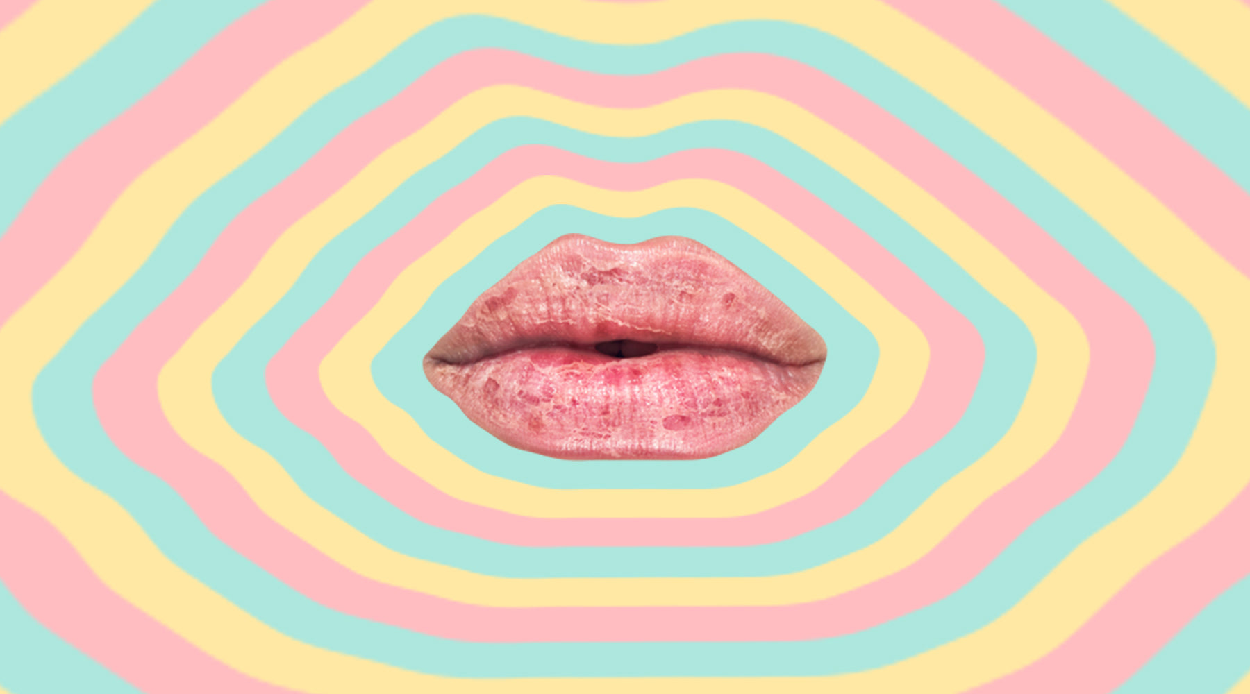Nothing Is Working For Your Dry & Chapped Lips? Read This!