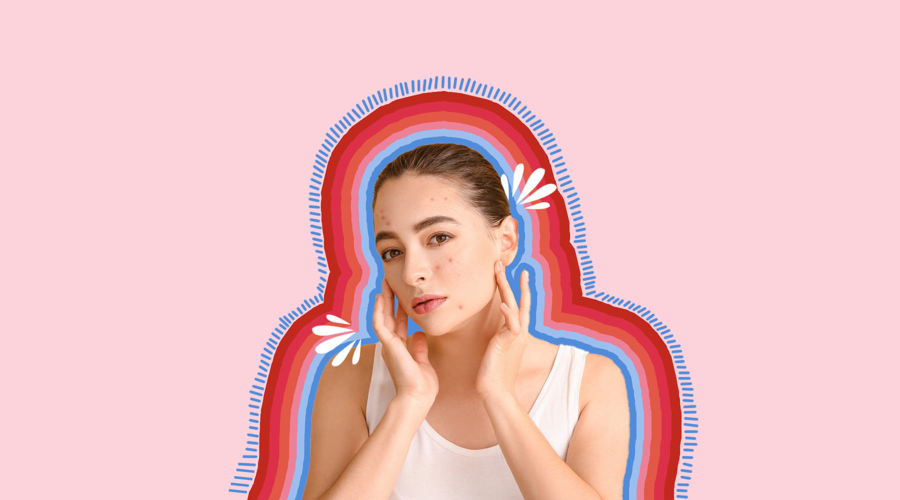 These Skincare Mistakes Might Be Worsening Your Acne