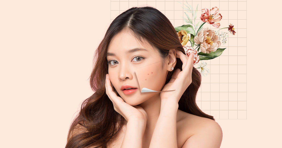 How To Treat And Prevent Pitted Acne Scars – Quench Botanics