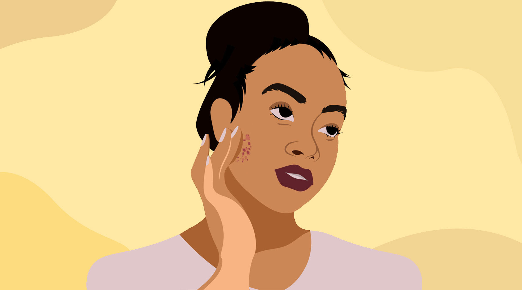 Here's What To Do When You Get A Pimple Before A Big Date!