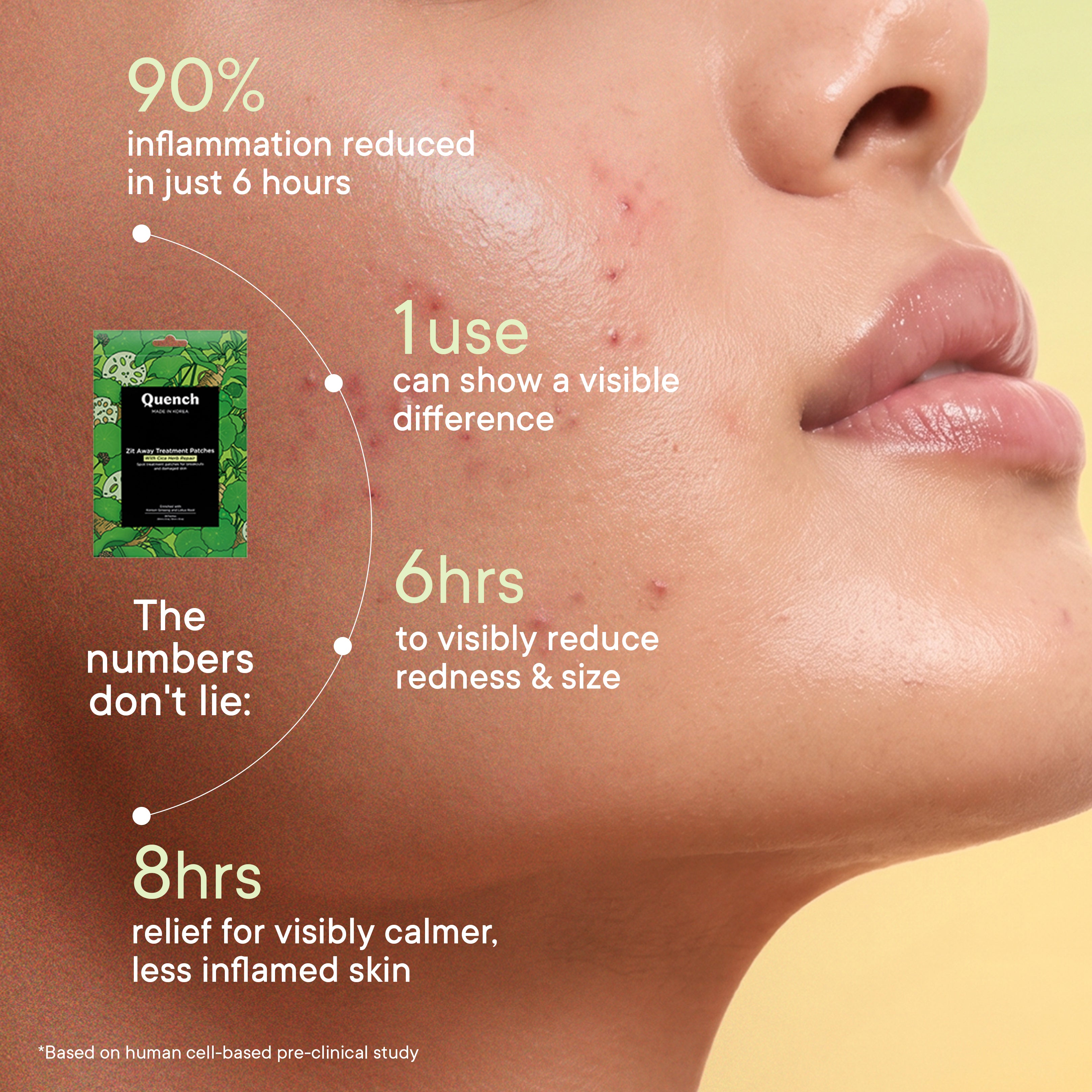 Zit Away Treatment Patches with Cica Herb Repair - 24 PATCHES