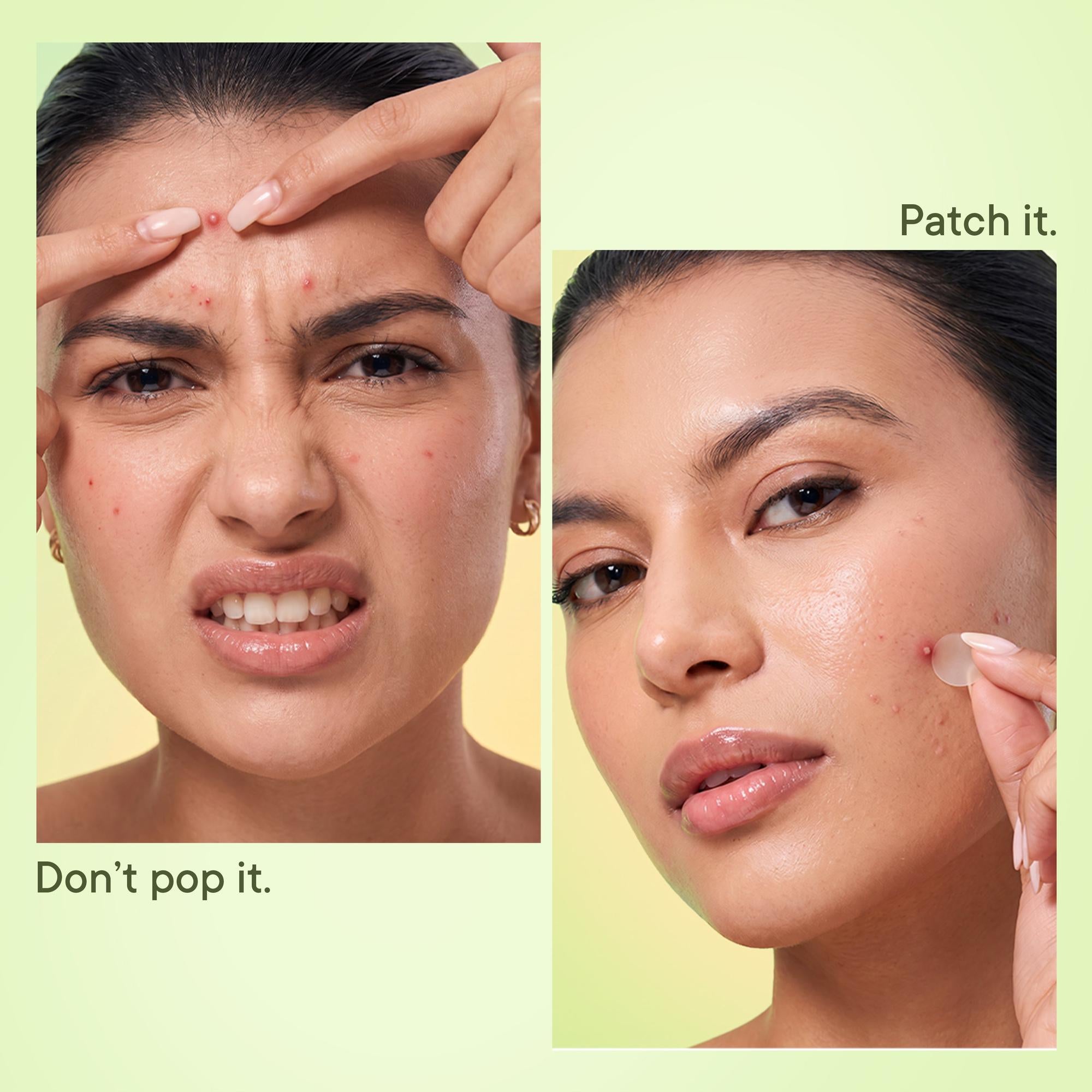Zit Away Treatment Patches with Cica Herb Repair - 24 PATCHES